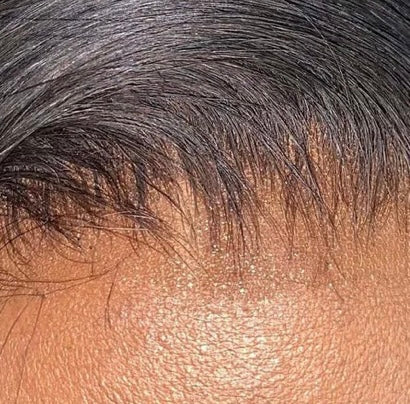 5"x5" Raw Silky Straight Closure
